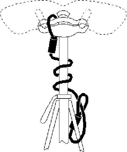 Kryptoflex 525 Double Loop Cable